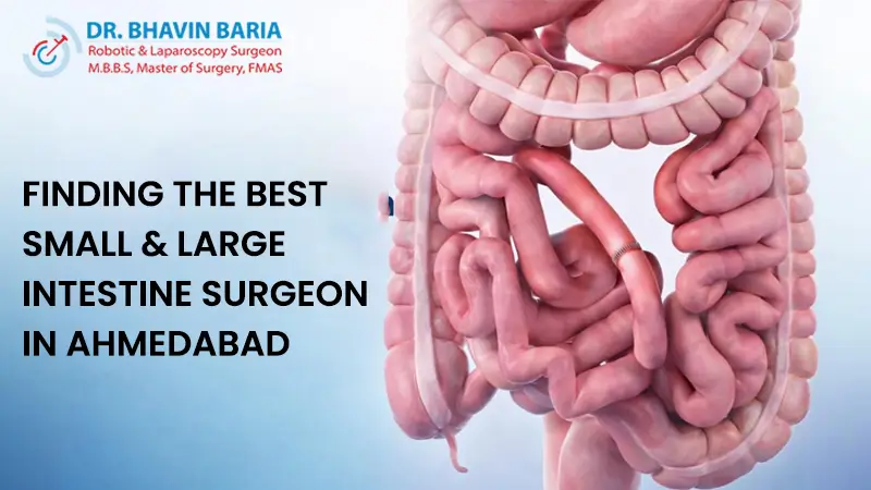 Finding the Best Small & Large Intestine Surgeon in Ahmedabad