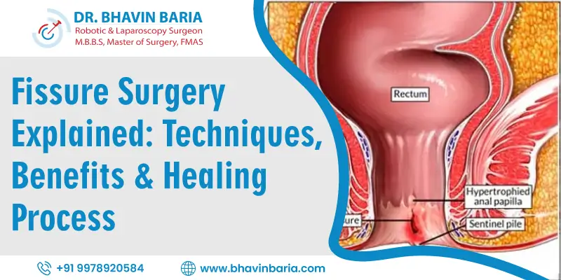 Fissure Surgery Explained: Techniques, Benefits & Healing Process