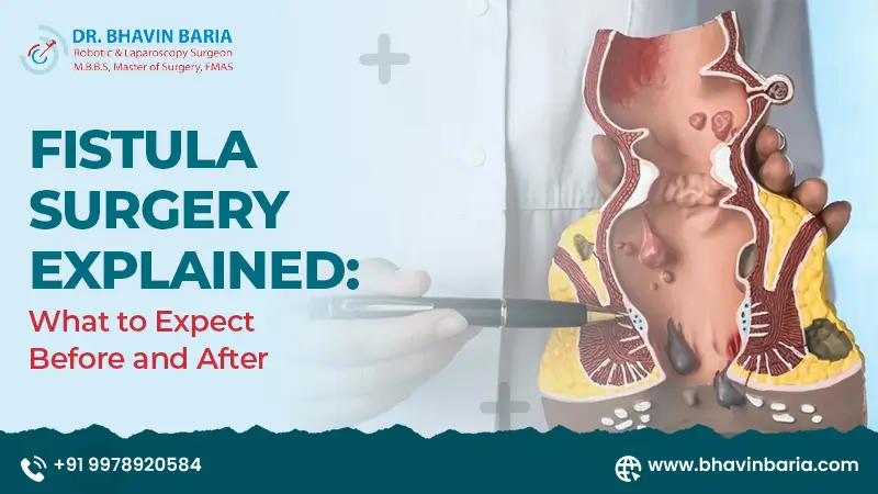 Fistula Surgery Explained: What to Expect Before and After