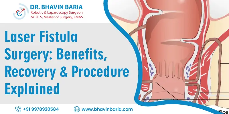 Laser Fistula Surgery: Benefits, Recovery & Procedure Explained