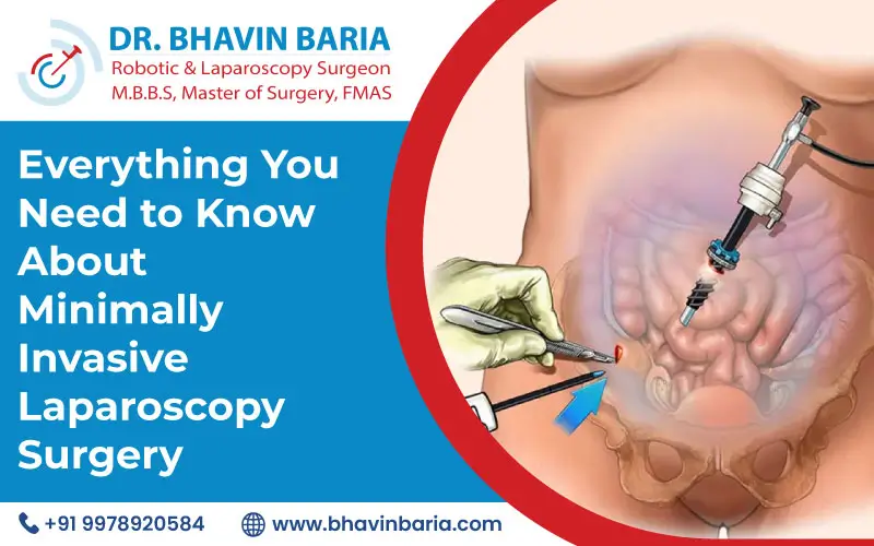 Everything You Need to Know About Minimally Invasive Laparoscopy Surgery