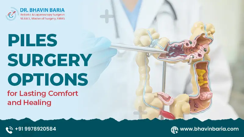 Piles Surgery Options for Lasting Comfort and Healing