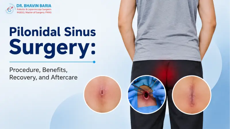 Pilonidal Sinus Surgery: Procedure, Benefits, Recovery, and Aftercare